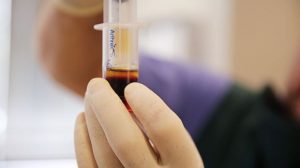 PRP Injection