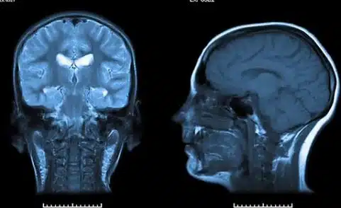 In the Field of Radiology You Need a Subspecialist, not a Generalist